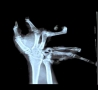 Cool Pictures - Unreal X-Ray Pictures