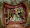 Cool Pictures - World's Ugliest Teeth