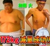 Funny Pictures - Before and After Weight Loss