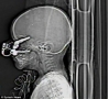 Weird Funny Pictures - Keys Stuck in His Brain